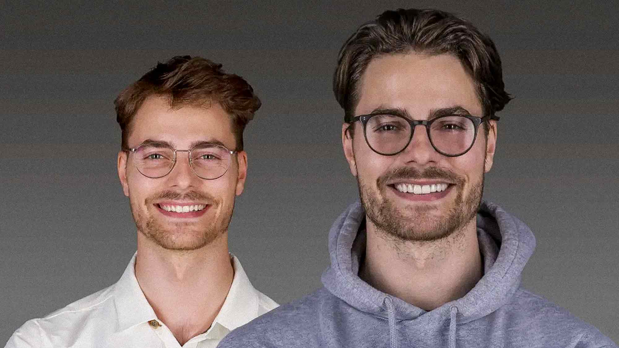 Zu perfekt, um echt zu sein? Erstklassige Veneers sind vor allem eines: Unauffällig! Zu perfekt, um echt zu sein? Erstklassige Veneers sind vor allem eines: Unauffällig!