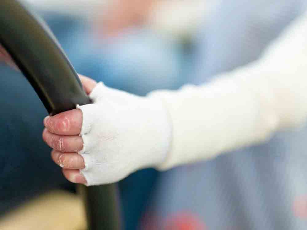 Gütersloh, seltene Erkrankungen, Ergotherapeut begleitet Kinder mit Epidermolysis bullosa, besser bekannt als »Schmetterlingskinder« Gütersloh, seltene Erkrankungen, Ergotherapeut begleitet Kinder mit Epidermolysis bullosa, besser bekannt als »Schmetterlingskinder«
