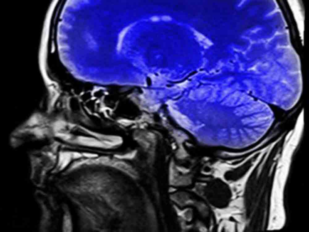 Ultraschall verringert Parkinson Symptome, »Exablate Neuro« verbessert Zittern und Mobilität bei 70 Prozent der betroffnenen Patienten Ultraschall verringert Parkinson Symptome, »Exablate Neuro« verbessert Zittern und Mobilität bei 70 Prozent der betroffnenen Patienten