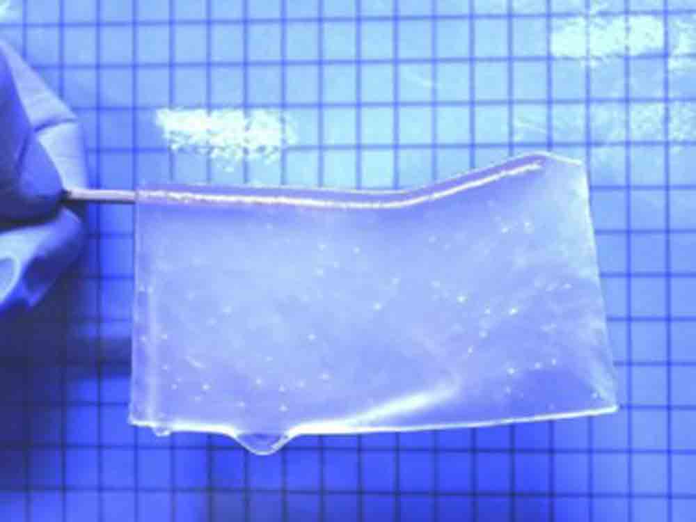 Forscher züchten Hirngewebe erfolgreich nach, vielversprechendes Hydrogel an Mäusen getestet, Heilung neurodegenerativer Leiden als Ziel