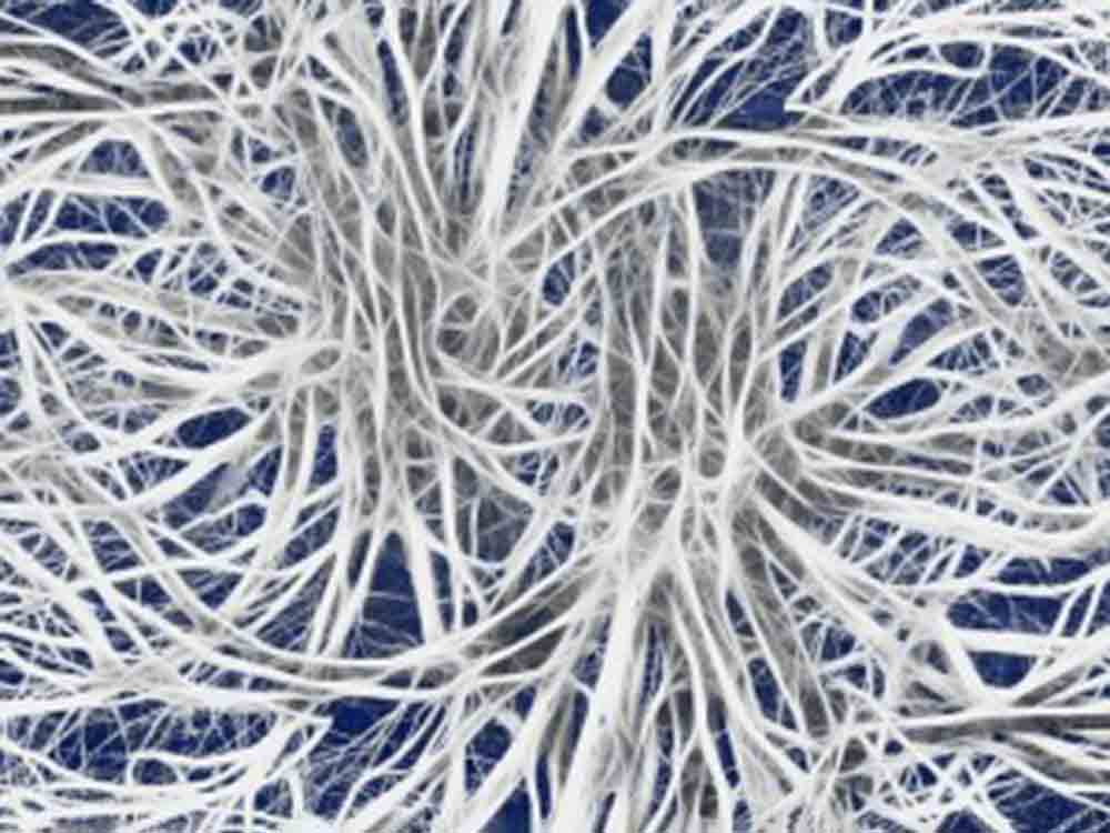 Parkinson: Wurm untersucht Ursache im Darm, Wissenschaftlerin versucht zu ergründen, wie sich Alpha Synuclein auf die Kognition auswirkt Parkinson: Wurm untersucht Ursache im Darm, Wissenschaftlerin versucht zu ergründen, wie sich Alpha Synuclein auf die Kognition auswirkt