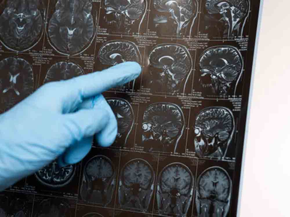 Neue Erkenntnisse für die Parkinson Therapie, Universitätsmedizin der Johannes Gutenberg Universität Mainz Neue Erkenntnisse für die Parkinson Therapie, Universitätsmedizin der Johannes Gutenberg Universität Mainz