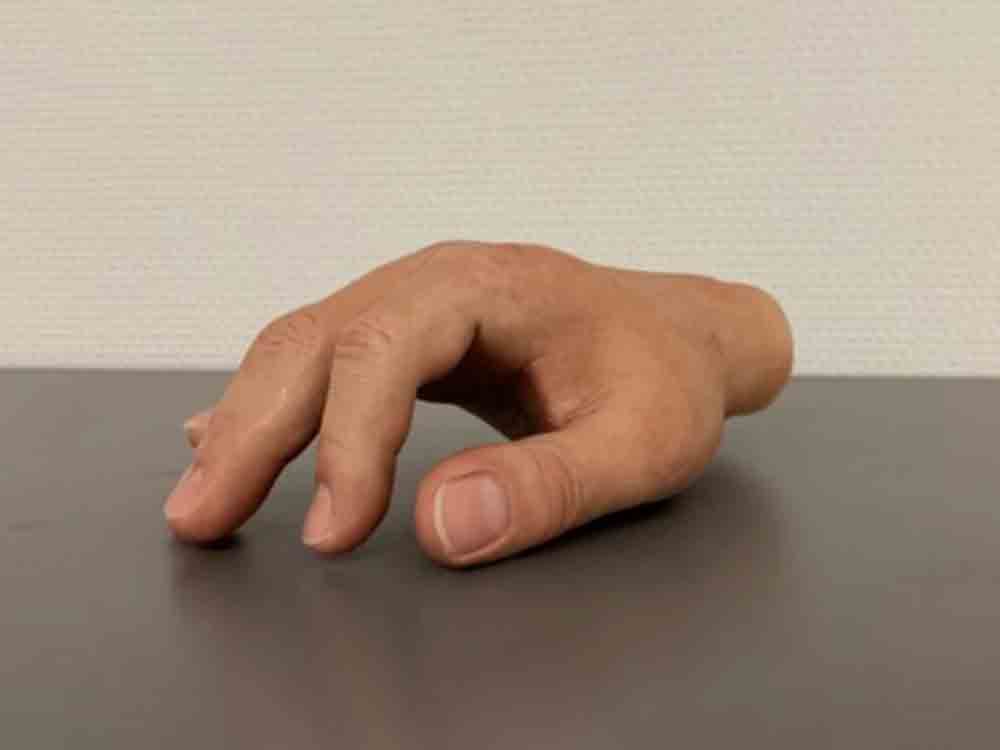 Forum Medizin zur Rapid Tech 3D zeigt: Immer mehr additiv hergestellte Produkte erfüllen die hohen medizinischen Standards Forum Medizin zur Rapid Tech 3D zeigt: Immer mehr additiv hergestellte Produkte erfüllen die hohen medizinischen Standards