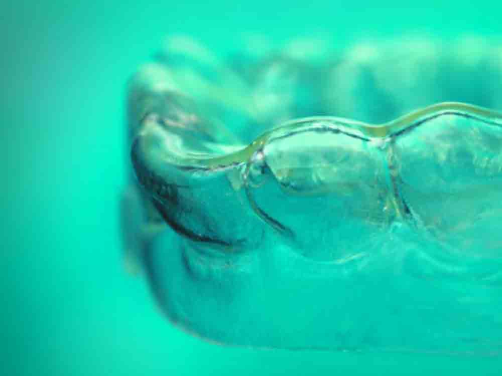 Intelligente Materialien für die Aligner Therapie: nachhaltiger, kostengünstiger, schonender, Fraunhofer Institut für Angewandte Polymerforschung IAP