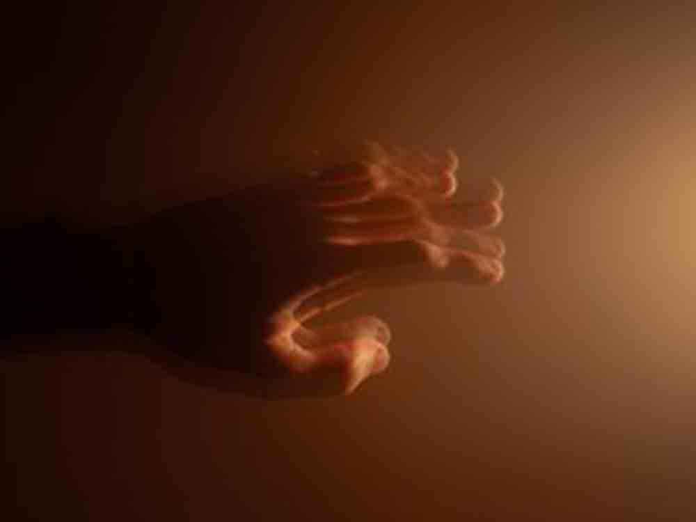 Parkinson: Handys und Watches für Diagnose, Wissenschaftler erhalten durch Nutzungsdaten deutlich tieferen Einblick, neue Therapien als Ziel