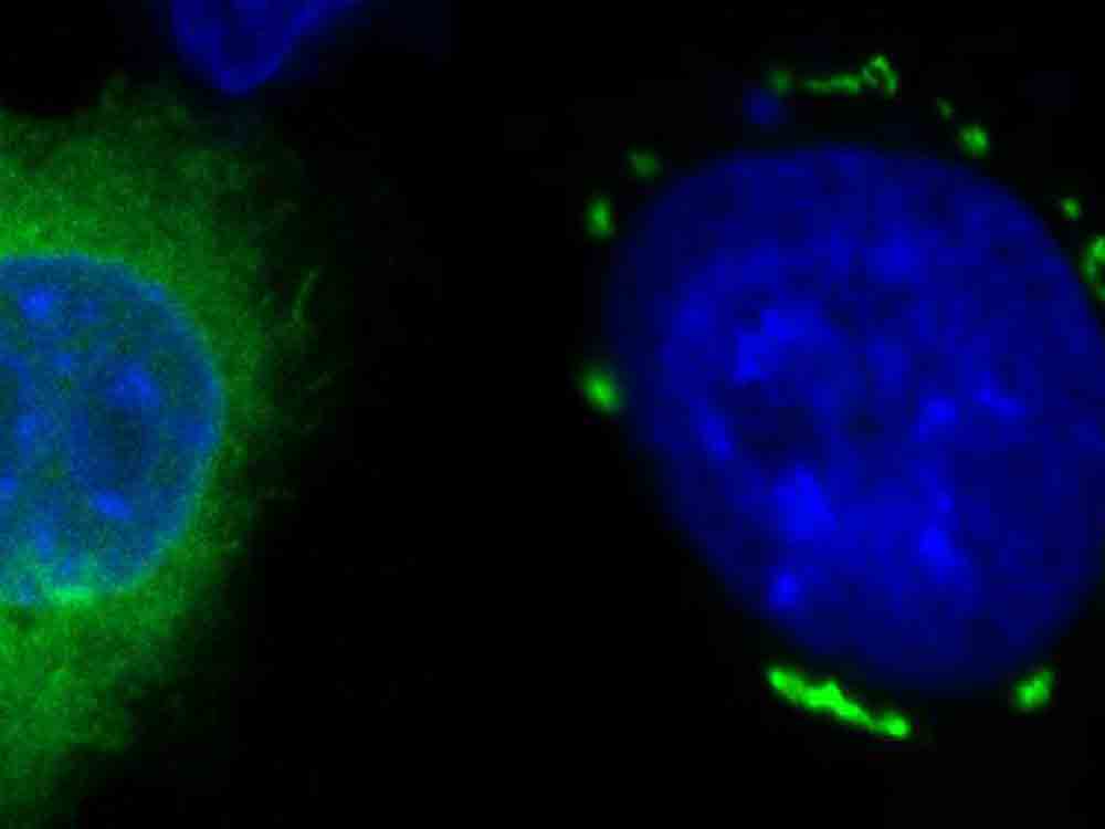 Neuer Ansatz in der Krebstherapie mit innovativem Mechanismus zur Induktion von Ferroptose, Helmholtz Zentrum München