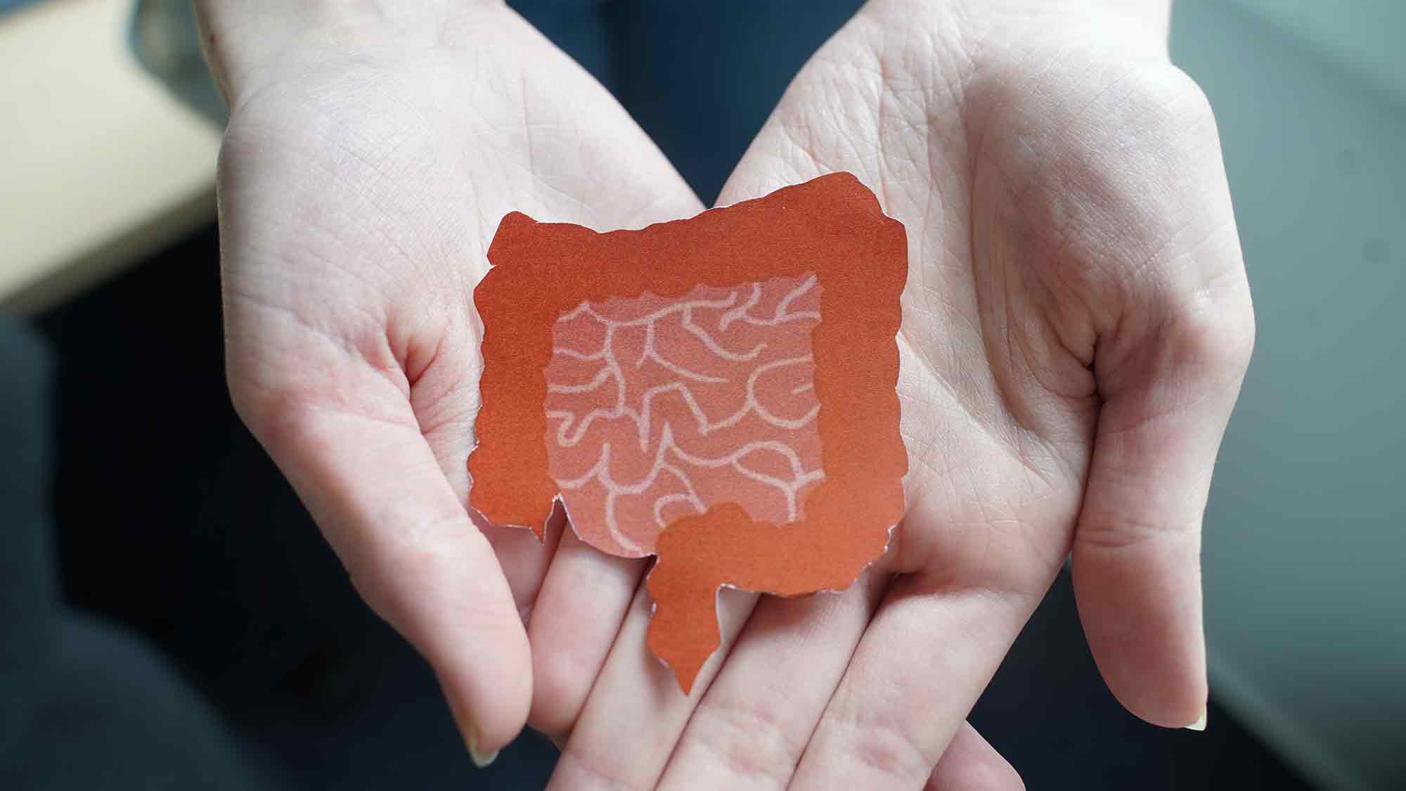 Klinikum Gütersloh: Keine Angst vor der Darmspiegelung, Führung durch die Endoskopie, 17. September 2024 Klinikum Gütersloh: Keine Angst vor der Darmspiegelung, Führung durch die Endoskopie, 17. September 2024
